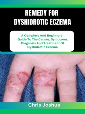cover image of REMEDY FOR DYSHIDROTIC ECZEMA